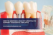 How to Maintain a Healthy Lifestyle to Support Your Dental Implants | Lambton Family Dental