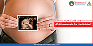 Reasons to Get 4D Ultrasounds During Pregnancy