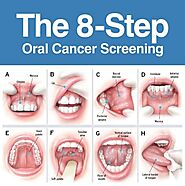 Oral Cancer Screening in Belleville