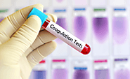 Study of Coagulation Testing Market: Hospital sector have positive Impact on the growth Globally