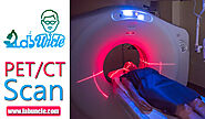 PET/CT Scan! Definition And Benefits
