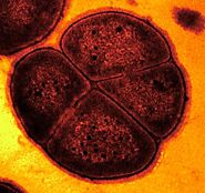  Deinococcus radiodurans-World's Toughest Bacteria