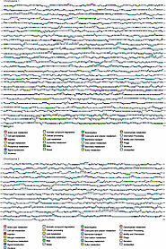 Complete genome sequence of Vibrio fischeri: A symbiotic bacterium with pathogenic congeners