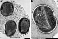 Alcanivorax borkumensis - microbewiki