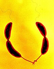 Gram negative and it rod shaped Caulobacter crescentus