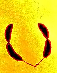 Caulobacter crescentus - microbewiki