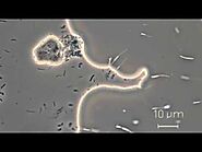 Stalked bacteria - Caulobacter spp.