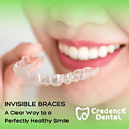 Invisible Braces – A Clear Way to a Perfectly Healthy Smile | Credence Dental