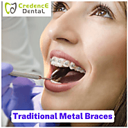 Traditional Metal Braces | Credence Dental