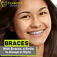 With Braces – Bright and Beautiful Smile is No Longer a Dream!