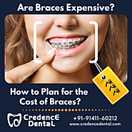 Website at https://credencedental.com/are-braces-expensive/
