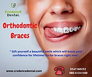 Website at https://credencedental.com/service/orthodontics/