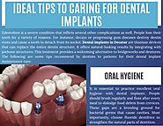 Ideal Tips to Caring for Dental Implants