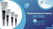 Get Full Mouth Restoration with Implant Treatment