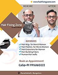 Baldness treatment - Hair Fixing Services in Bangalore