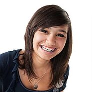 Life with Braces | Take care of your braces | Parrish Orthodontics