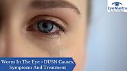 Intense Pulsed Light (IPL) Treatment for Dry Eyes Disease due to MGD