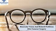 Binocular Vision And Related Problems After Cataract Surgery