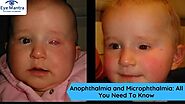 Anophthalmia and Microphthalmia: All You Need To Know