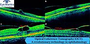 Optical Coherence Tomography (OCT): A revolutionary technology