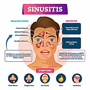 HOMEOPATHIC TREATMENT FOR SINUSITIS AND NASAL CONGESTION | Philadelphia Homeopathic Clinic