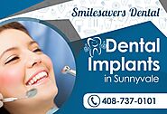 Best Invisible Braces in Sunnyvale | Smilesavers Dental