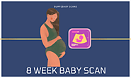 8 Week baby Scan – babyscan