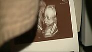 Are 3d/4d Ultrasounds Safe? - AtoAllinks