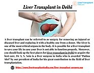 Visit for Liver Transplant in Delhi