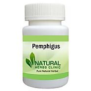 Herbal Treatment for Pemphigus - Natural Herbs Clinic