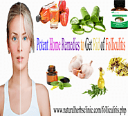 7 Potent Home Remedies to Get Rid of Folliculitis