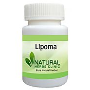 Herbal Treatment for Lipoma - Natural Herbs Clinic