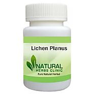 Herbal Treatment for Lichen Planus - Natural Herbs Clinic
