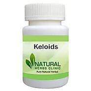 Herbal Treatment for Keloids - Natural Herbs Clinic