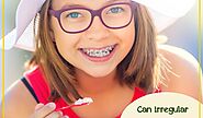 Does your child has malaligned teeth?