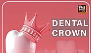🦷 FMS Dental Clinic Jubilee Hills Best Dental Clinic In Hyderabad India.
