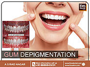 🦷 How do you get cured of dark gums?