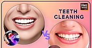 🦷Difference Between Teeth Whitening and Teeth Cleaning