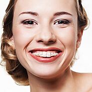 Parrish Orthodontics - What Are the Benefits of Orthodontic Treatment?