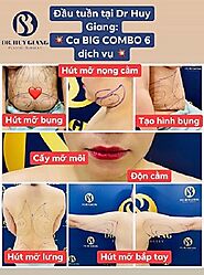 Hút mỡ toàn thân - Body hoàn hảo không mỡ thừa - Dr.Huy Giang