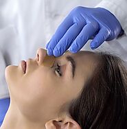 7 Essential Tips for Septoplasty Recovery