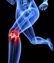 What To Expect During And After Knee Replacement Surgery