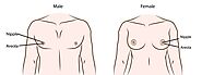 Nâng ngực cho người chuyển giới - Hành trình lột xác - Dr.Huy Giang