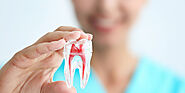 Root canal cost Bangalore