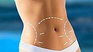 Hourglass Tummy Tuck treatment by Dr. Claudine Roura