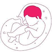 Pregnancy Doctor in Tirunelveli For Ectopic Pregnancy