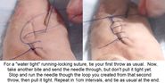 Learn How to Repair Lacerations with This Super Easy Technique!
