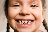 What is the Process of Getting Braces?