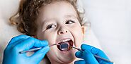 Different Types of Dental Fillings available at the Carlsbad Pediatric Dentistry