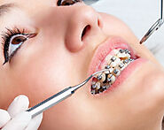 Everything You Need to know about Preventative Orthodontics from a Carlsbad Orthodontist